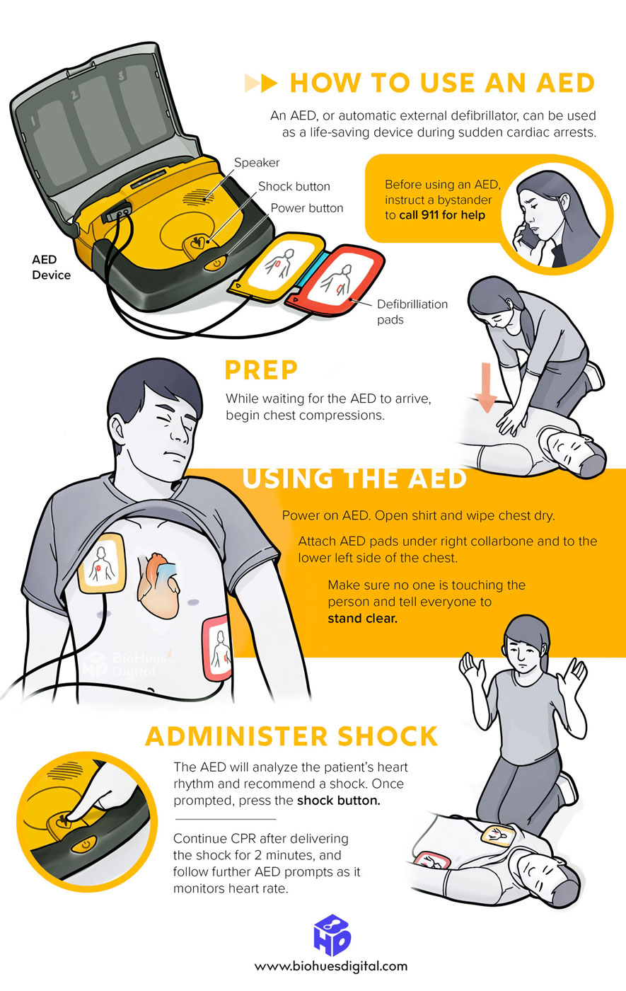 How to use AED educational poster infographic