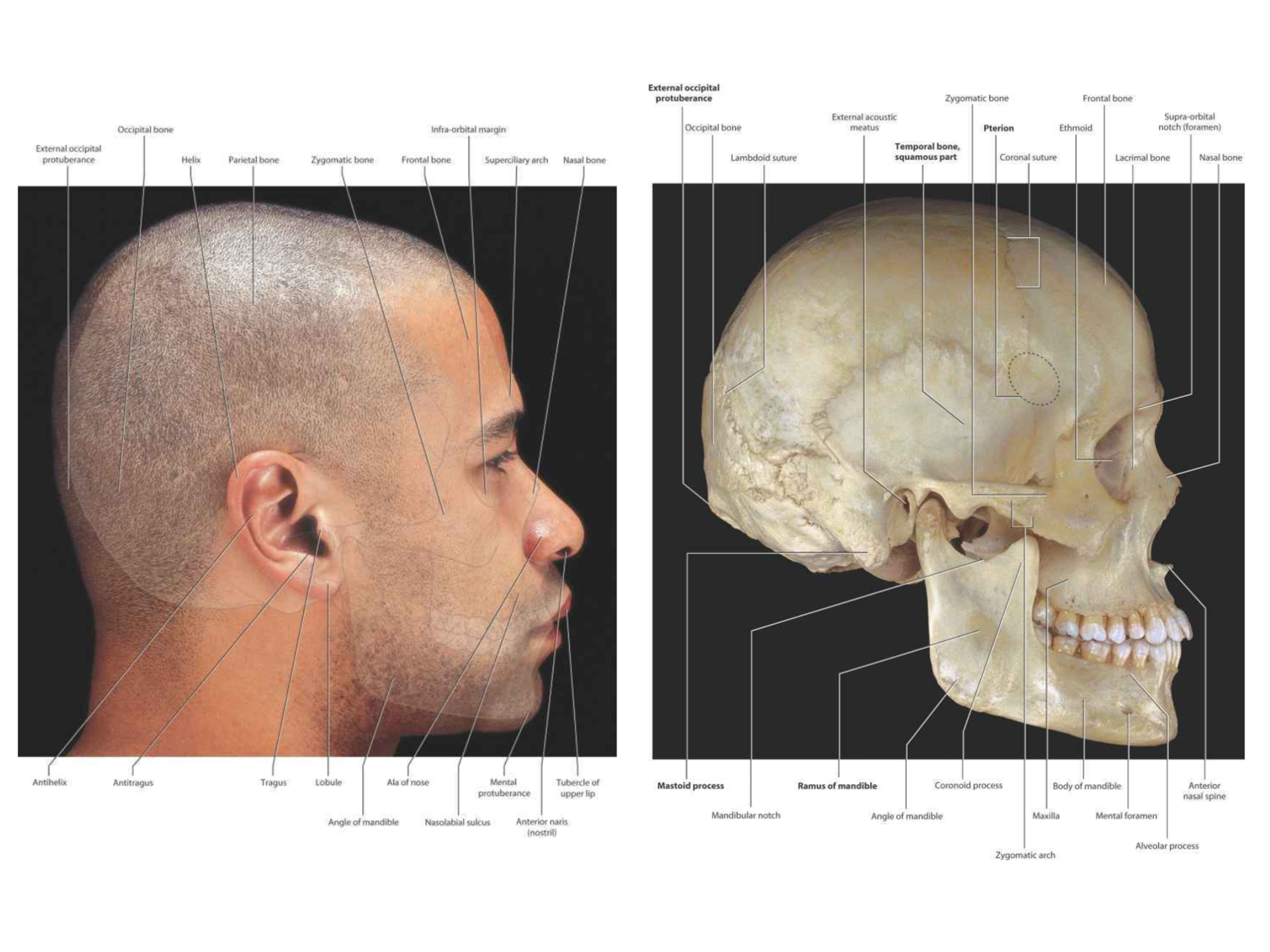 image of skull anatomy