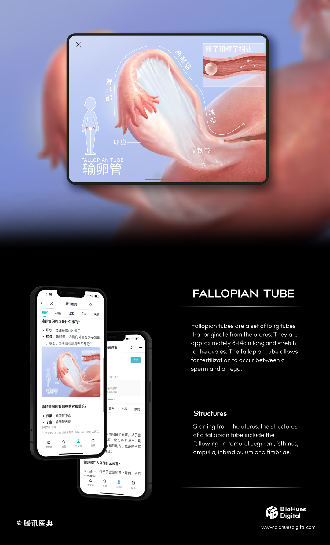 image of uterus and fallopian tube